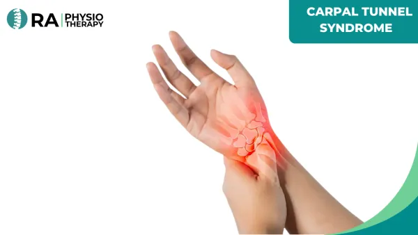 Carpal Tunnel Syndrome (cts)