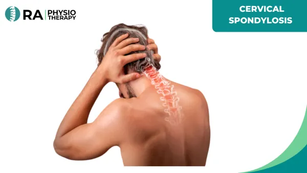 Cervical Spondylosis