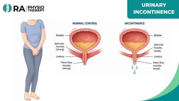 Urinary Incontinence