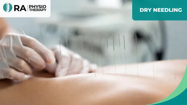 Dry Needling