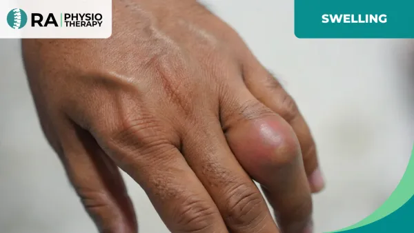 Swelling